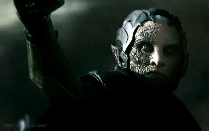 It's a skin condition. Don't stare at me.